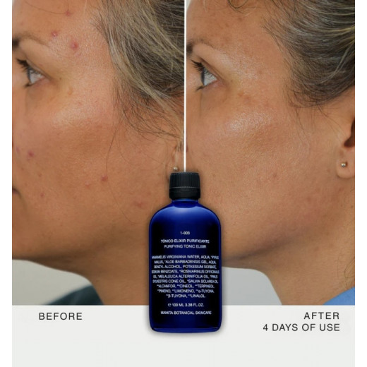 1-003 Purifying Tonic Elixir